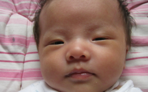 1448526524547269.png 寶寶一個多月了還有黃疸是怎么回事