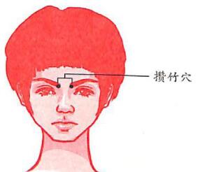 頭痛怎么辦?緩解頭痛的穴位按摩法