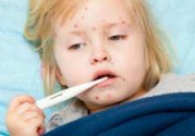 孩子得了水痘全身很癢怎么辦?緩解水痘瘙癢妙招