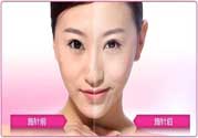 美白針真的有效嗎？美白針的危害有哪些？
