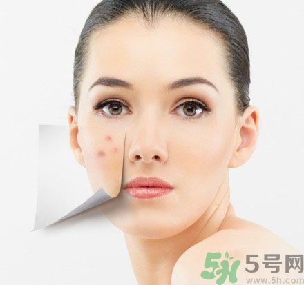 臉上有斑怎么去除？祛斑的小偏方有哪些？