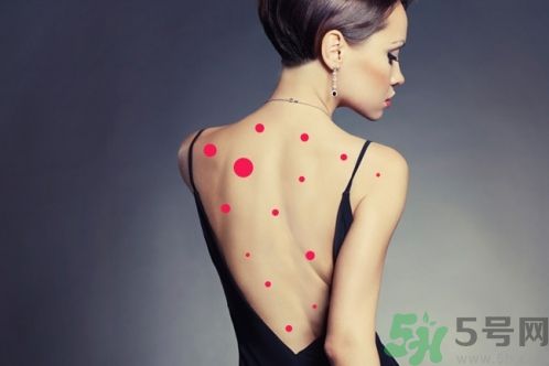 背上為什么會(huì)長(zhǎng)痘痘？長(zhǎng)痘痘怎么辦？