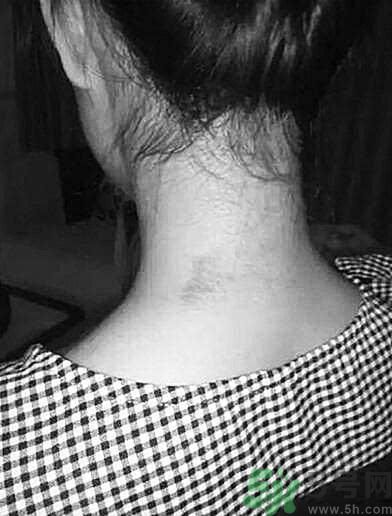 老師水潑女生遭腳踢后流產 老師打我我該怎么辦