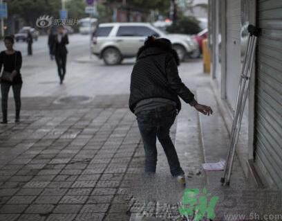 學(xué)生患東方美女病是怎么回事？東方美女病是什么?。? width=