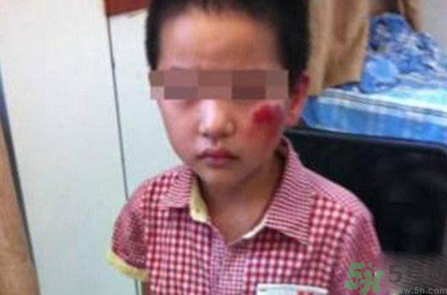 男孩遭校長暴打的結(jié)果是什么？男孩遭校長暴打的真相是什么？