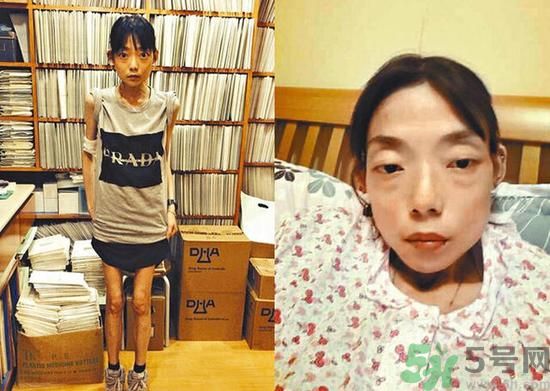 富二代離婚娶二線女星前妻瘦成骷髏  怎么選擇有責(zé)任的男人？