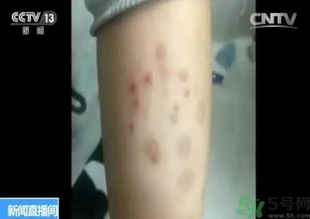 被污染學(xué)校是哪個(gè)？500師生患病的原因？