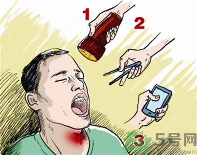 魚刺卡喉喝醋可以治療嗎？魚刺卡喉喝醋好不好？