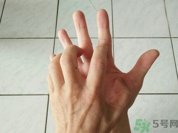 手上起水泡是什么原因？怎樣預(yù)防手上起水泡？