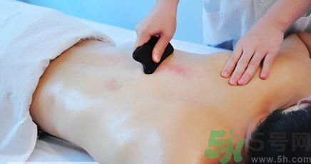 夏季刮痧好嗎？刮痧能治療什么疾?。? width=