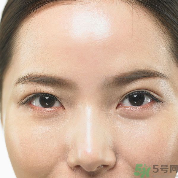 眉周紋是怎么形成的？眉周紋怎么去除？