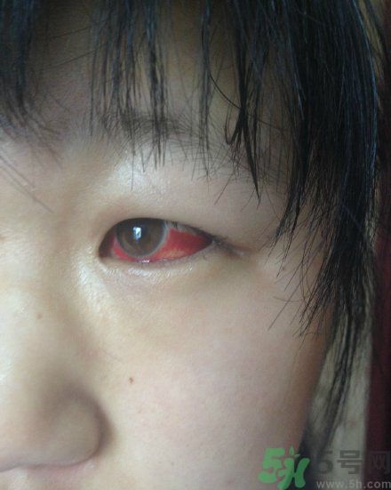 初中生全體甲醛中毒是怎么回事？初中生全體甲醛中毒是哪個學校？