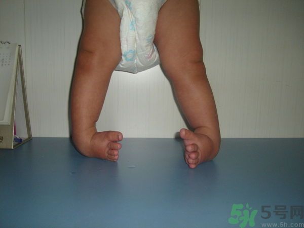 女生3天花8萬是怎么回事？馬蹄足是什么??？
