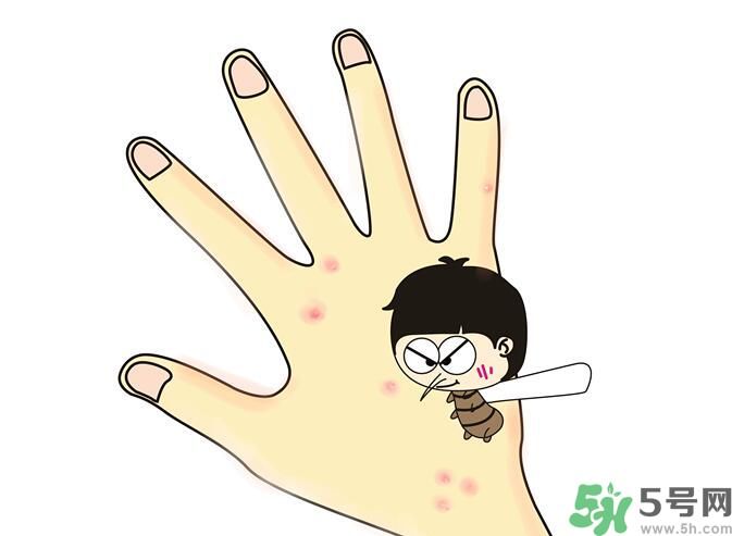 蚊子叮的包過(guò)幾天又癢是為什么？蚊子叮的包過(guò)幾天又癢怎么辦？
