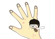 蚊子叮的包過幾天又癢是為什么？蚊子叮的包過幾天又癢怎么辦？