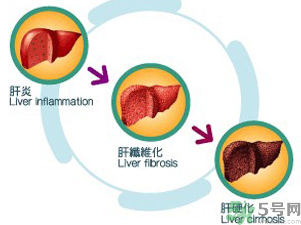 在外面吃飯會(huì)得乙肝嗎？在食堂吃飯會(huì)得乙肝嗎？