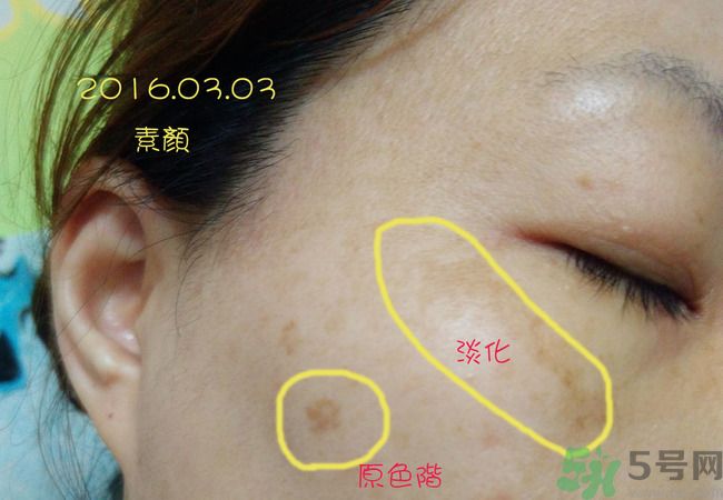 sk2祛斑精華怎么樣？skii祛斑精華使用方法