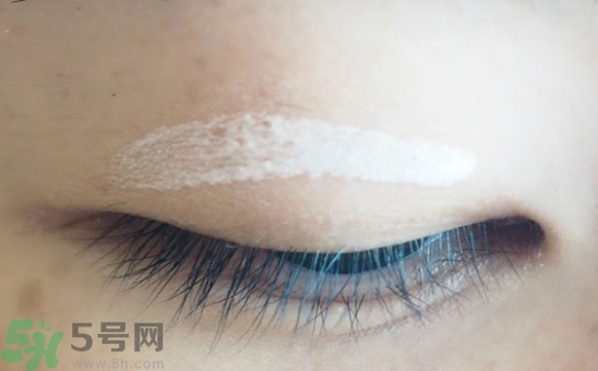 單眼皮怎么變雙眼皮了？單眼皮上面有一條線