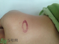 種草莓吻痕是什么意思？吻痕是怎么弄出來(lái)的？