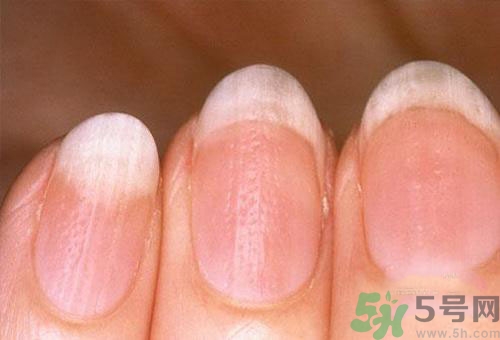 指甲發(fā)白是怎么回事？指甲發(fā)白代表什么？