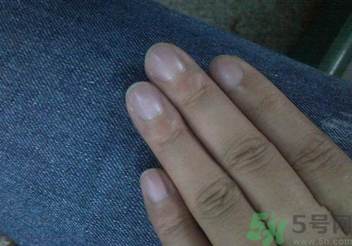 指甲發(fā)紫是什么原因？指甲發(fā)紫是怎么回事？