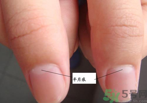 指甲沒有月牙是什么原因？指甲沒有月牙怎么調(diào)理？