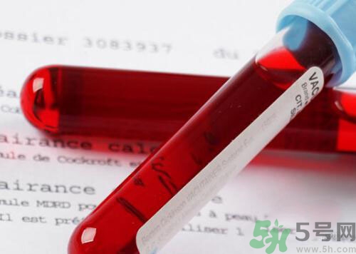 獻(xiàn)血后可以洗澡嗎？抽血后可以洗澡嗎？