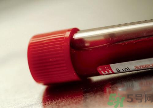 獻(xiàn)血后可以洗澡嗎？抽血后可以洗澡嗎？