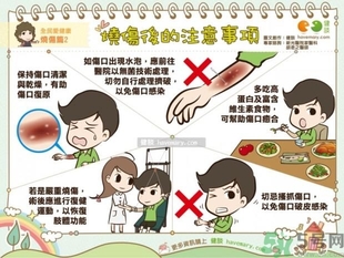 手被油燙傷了怎么處理？手被油燙起泡了怎么辦？