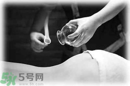 大暑可以拔罐嗎？大暑拔罐好不好？