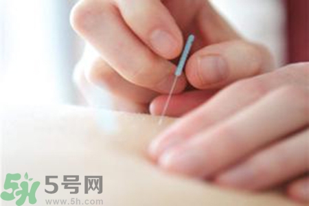 大暑可以針灸嗎？大暑針灸好不好？