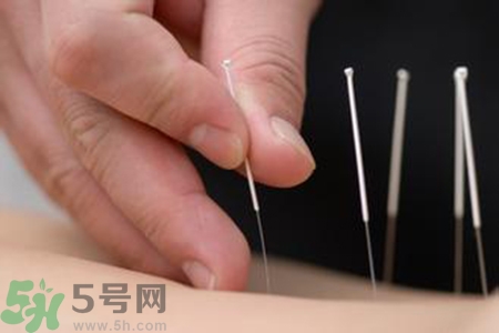 大暑可以針灸嗎？大暑針灸好不好？