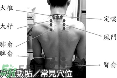 經(jīng)期可以貼三伏貼嗎？來月經(jīng)可以貼三伏貼嗎？