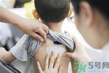 肝炎貼三伏貼有用嗎？肝病貼三伏貼貼哪里？