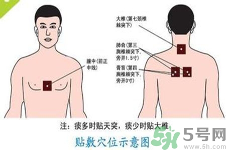 三伏貼能治頸椎病嗎？頸椎病三伏貼穴位