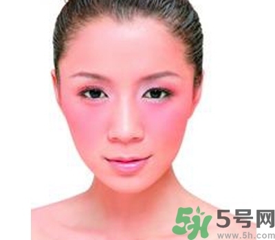 敏感性皮膚用什么洗面奶？敏感性皮膚怎么修復？