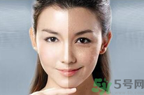 干性皮膚用什么洗面奶？干性皮膚該怎么保養(yǎng)？