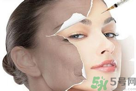 美白針效果怎么樣？美白針有副作用嗎？