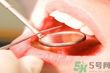 冷光美白牙齒是什么？冷光美白牙齒的好處有哪些？