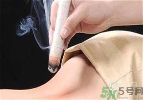 蕁麻疹可以艾灸嗎？蕁麻疹艾灸哪個穴位？