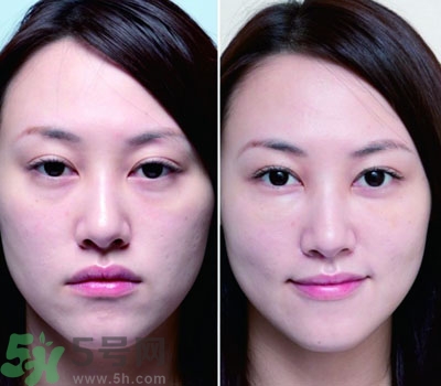 臥蠶是什么？臥蠶是眼袋嗎？