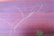 生完寶寶白頭發(fā)的原因？生完寶寶白頭發(fā)怎么辦？