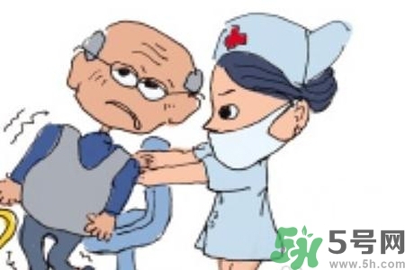 癲癇的典型癥狀有哪些？癲癇是什么？