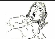 癲癇的發(fā)病因素？癲癇的并發(fā)癥有哪些？
