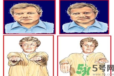 腦中風的治療方法？腦中風的藥物治療？