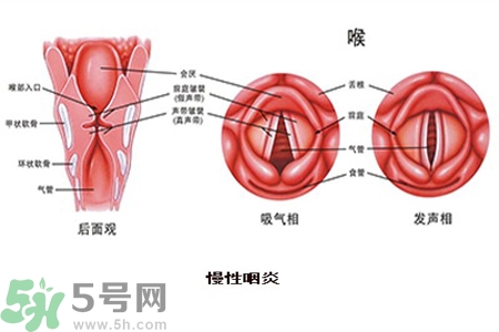 慢性咽炎是什么？慢性咽炎的癥狀有哪些？