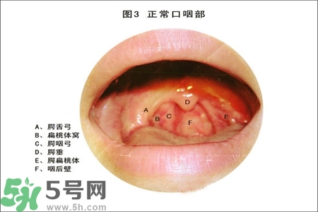 慢性咽炎的治療方法？慢性咽炎的藥物治療？