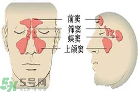 鼻竇炎是什么？鼻竇炎的癥狀有哪些？