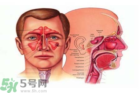 鼻竇炎是什么？鼻竇炎的癥狀有哪些？