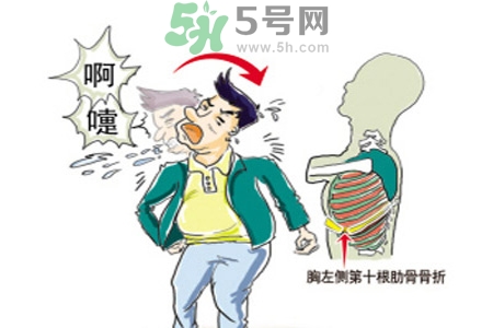 過敏性鼻炎是什么？過敏性鼻炎的癥狀有哪些？